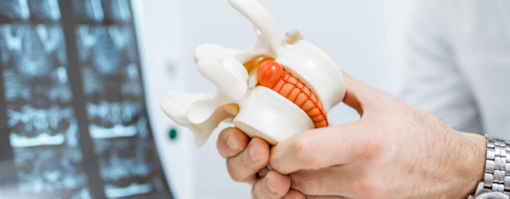 Back Pain Can Have Many Causes - Could Yours Be From a Herniated Disc?